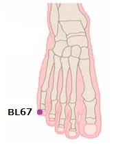 Acu-points for Breech Position1