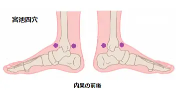 Acu-points for Menorrhagia1